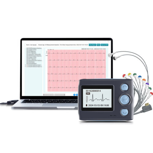 12 Lead Holter Monitor Recording 24h ECG and Heart Rate AI Analysis Abnormal ECG