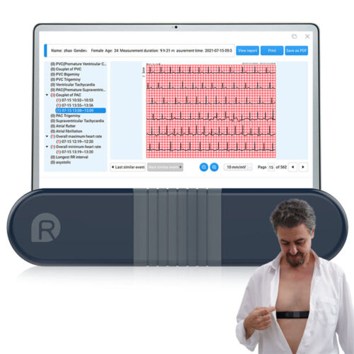 AI Analysis EKG Monitor Holter Monitor 24 Hrs with ECG Electrode and Chest Strap