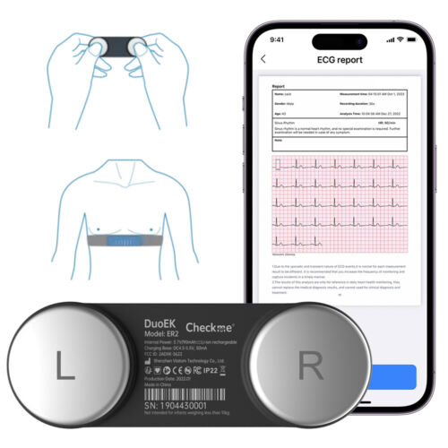 AI Personal Mobile ECG EKG Monitor 30s to 15 mins ECG Measurement Detects AFib