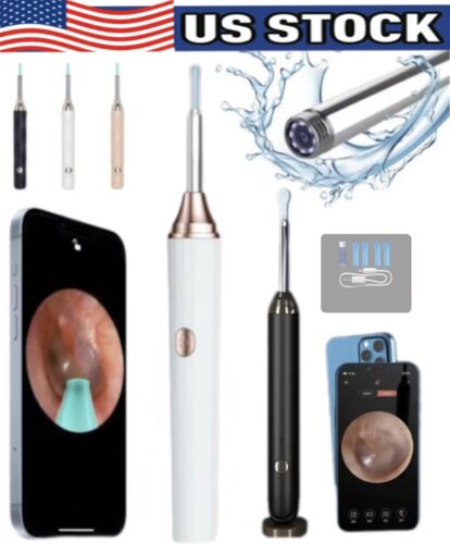 Ear Wax Removal Pick Led Wireless Ear Camera Otoscope Visual Kit eXempt Smart