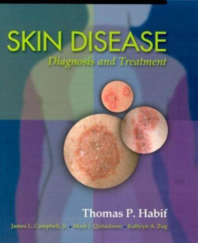 Skin Disease: Diagnosis and Treatment