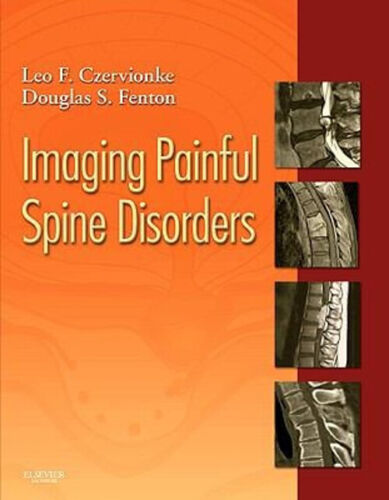 Imaging Painful Spine Disorders Hardcover Douglas S., Czervionke,