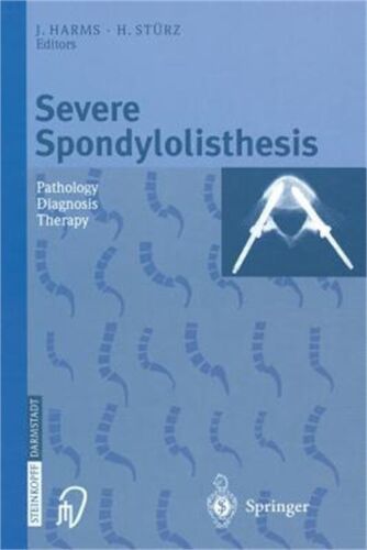 Severe Spondylolisthesis: Pathology – Diagnosis – Therapy (Paperback or Softback