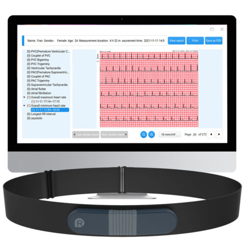 AI EKG Monitor Holter 24hrs Recording AI Analysis PC Software Heart Rate Monitor