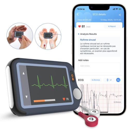 AI EKG Monitor Heart Rate Monitor 30s/60s/5mins Recording with free AI Analysis