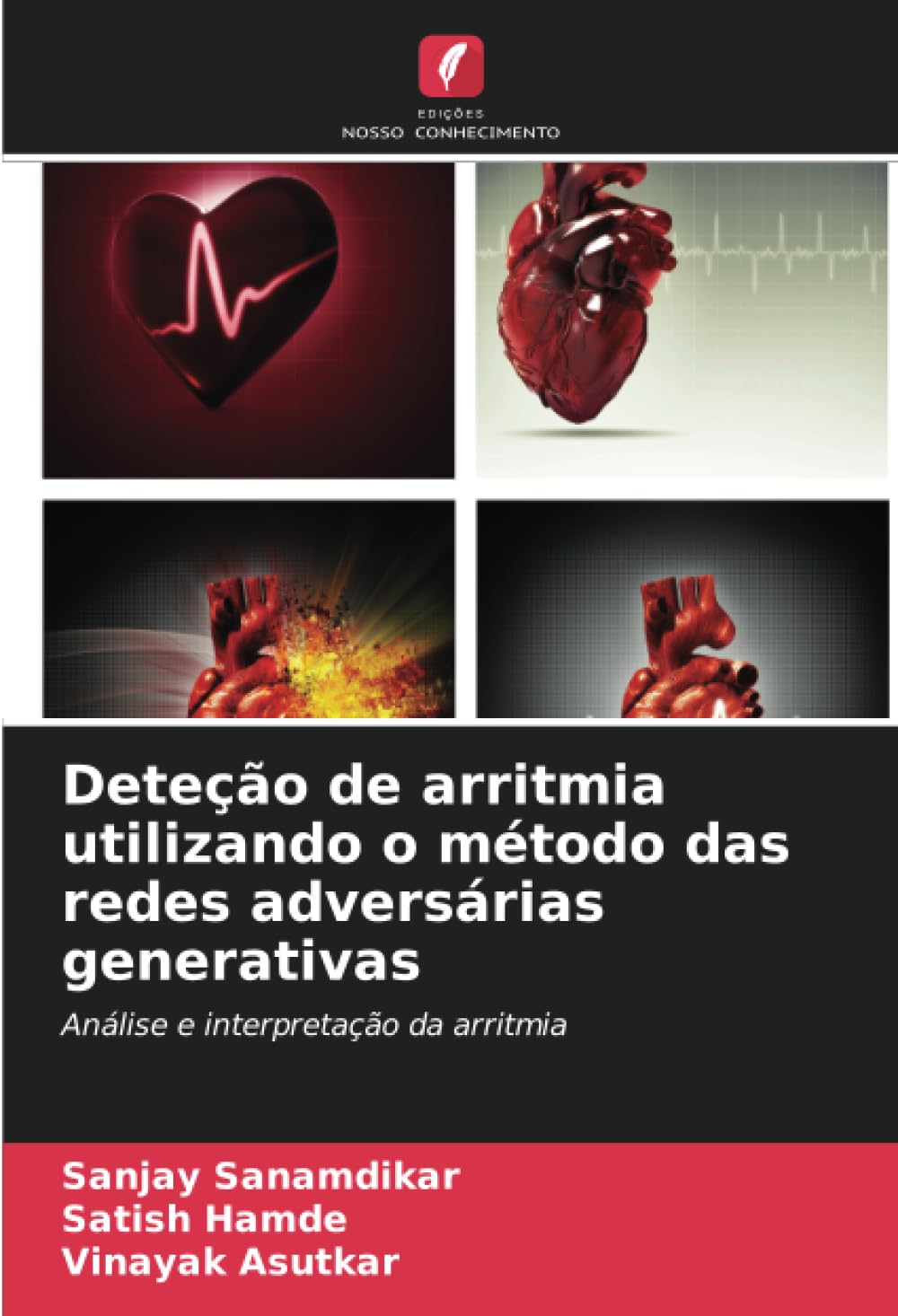 Deteção de arritmia utilizando o método das redes adversárias generativas: Análise e interpretação da arritmia (Portuguese Edition)