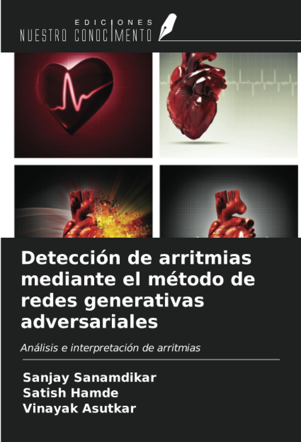 Detección de arritmias mediante el método de redes generativas adversariales: Análisis e interpretación de arritmias (Spanish Edition)