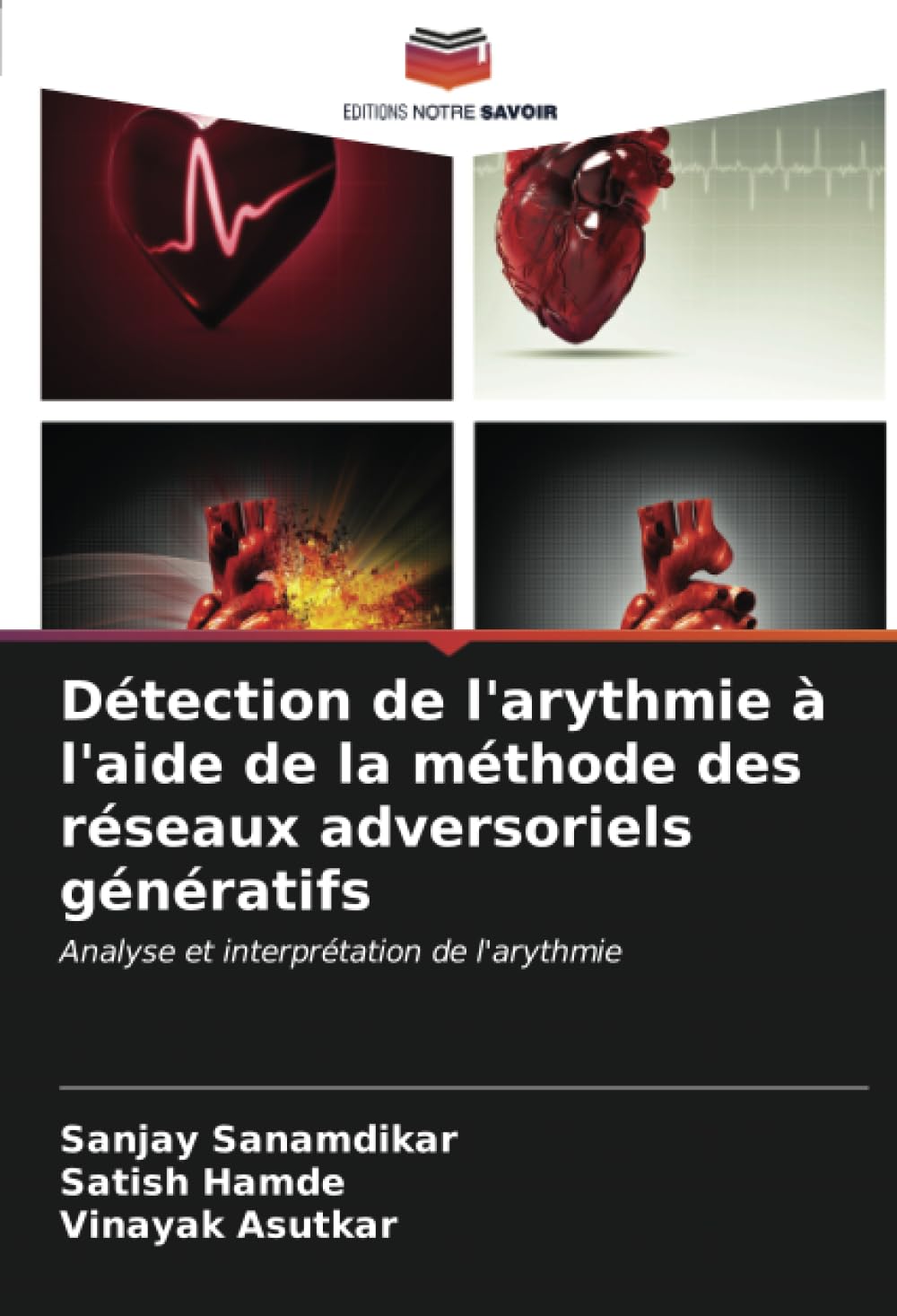 Détection de l’arythmie à l’aide de la méthode des réseaux adversoriels génératifs: Analyse et interprétation de l’arythmie (French Edition)