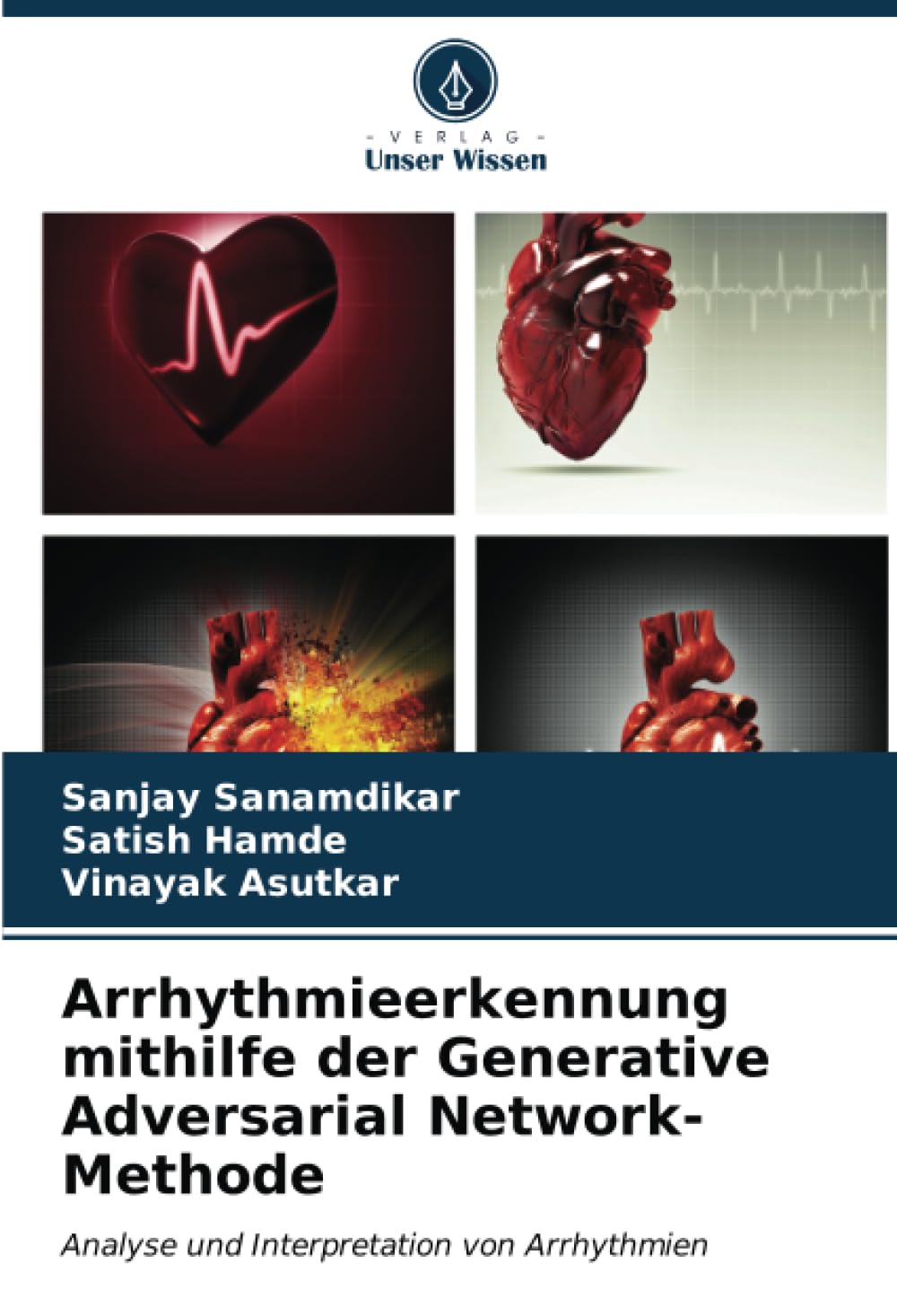 Arrhythmieerkennung mithilfe der Generative Adversarial Network-Methode: Analyse und Interpretation von Arrhythmien (German Edition)