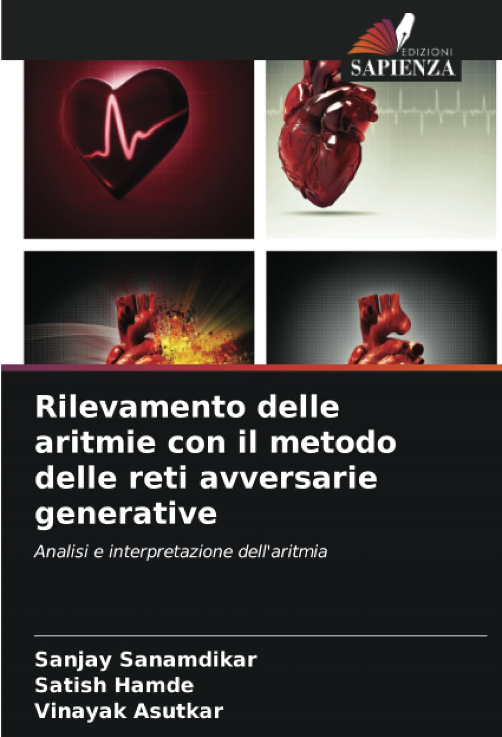 Rilevamento delle aritmie con il metodo delle reti avversarie generative: Analisi e interpretazione dell’aritmia (Italian Edition)