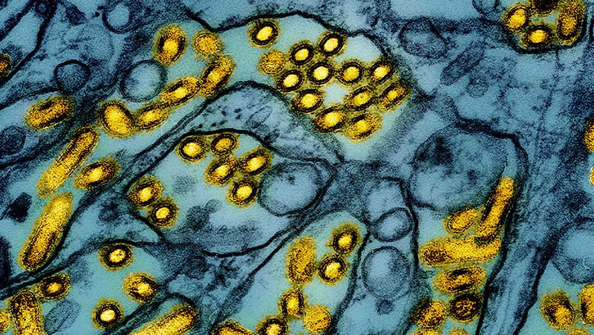 CDC warns of bird flu mutations in first severe U.S. case