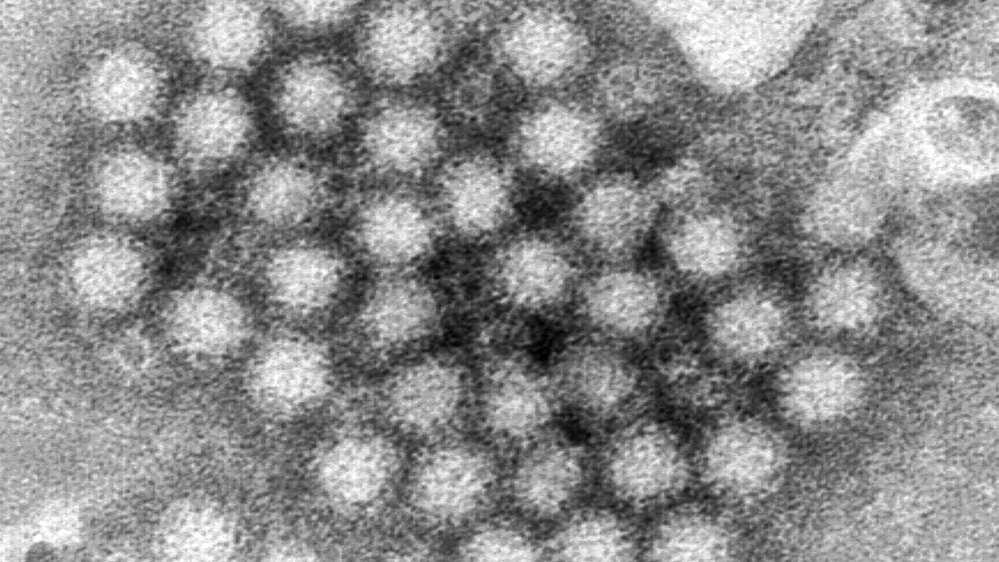 Norovirus cases are surging in U.S., CDC data shows