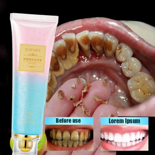 21 Days Teeth Whitening Niacinamide Whitening Toothpaste Niacinamide Toothpaste