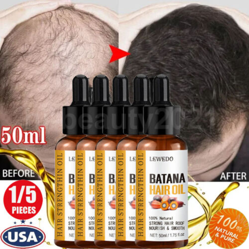 3/5PCS Batana Oil Serum For Hair Growth Anti-Hair Loss Damaged Hair Root Repair