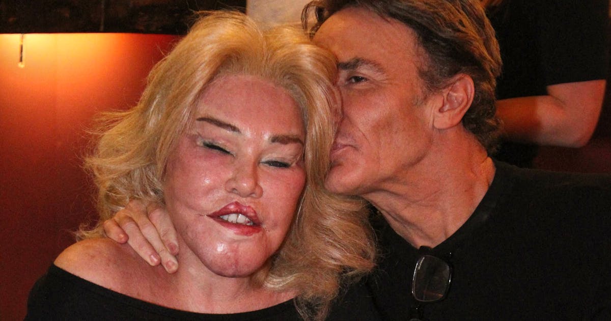 Jocelyn Wildenstein, Jetstetter (84): “I haven’t had any cosmetic surgery and I hate Botox”